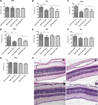 Frontiers Changes In Retinal Structure And Ultrastructure In The Aged